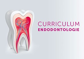 Zahn Endodontie
