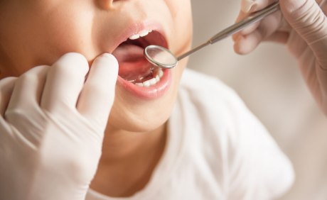 Offener Kindermund Spiegel Zahnarzt