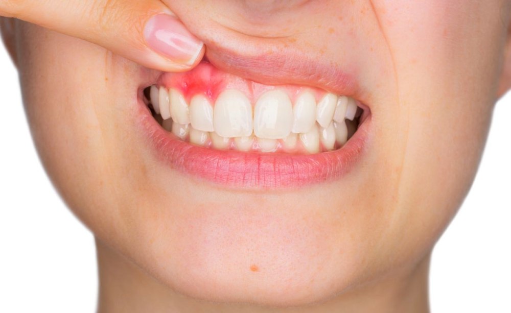 Der Kranke Zahn Ein Gefahrlicher Streuherd