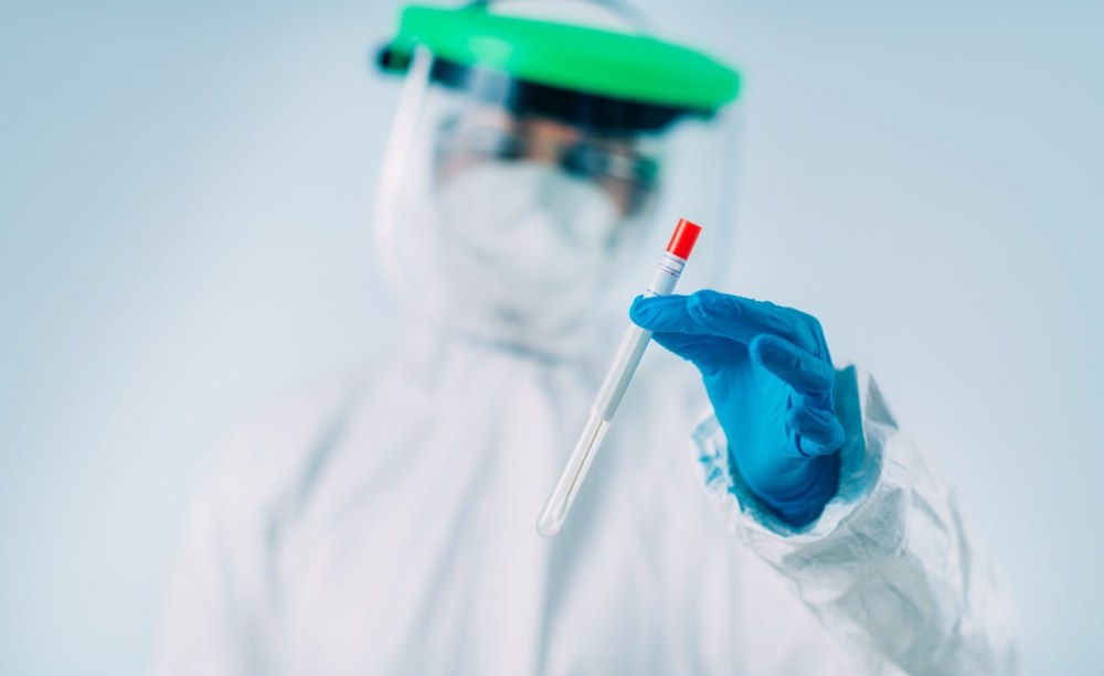Neue Coronavirus-Testverordnung des BMG: Zahnärzte nur im Auftrag des öffentlichen Gesundheitsdienstes zu Testungen ermächtigt. Neue Coronavirus-Testverordnung des BMG: Zahnärzte nur im Auftrag des öffentlichen Gesundheitsdienstes zu Testungen ermächtigt.