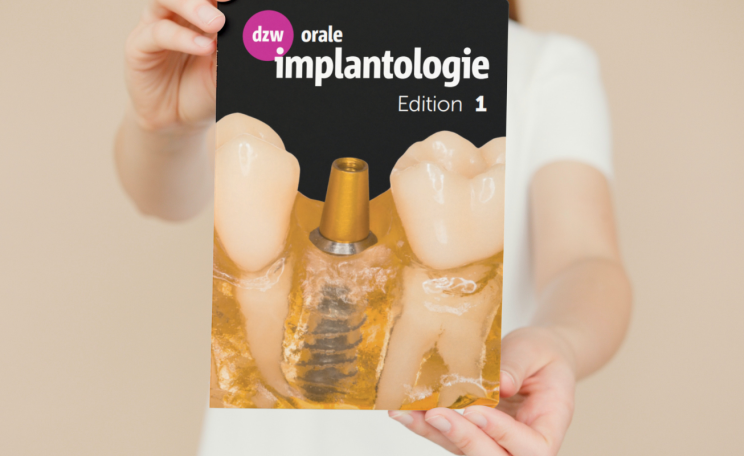 Orale Implantologie in Print