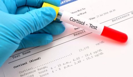 Cortisol-Test