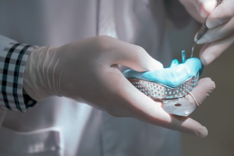 Abdrucklöffel wird von einem Zahnarzt mit Abformmasse beschickt