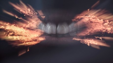 Tritt Mundtrockenheit kombiniert mit Zungenbrennen auf, kann dies auf eine eigenständige Erkrankung hinweisen: dem Burning Mouth Syndrom (BMS).