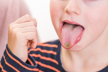 Behandlung Logopädie: Junge mit offenem Mund und einem kleinen Objekt auf der Zungenspitze