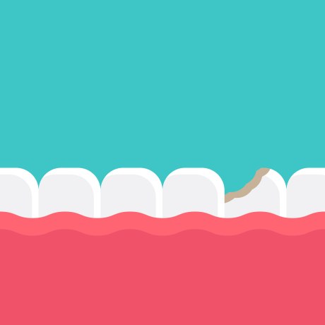 Ein Bild, das eine grafische Darstellung von Zähnen und Zahnfleisch zeigt, oben ist der Hintergund petrolfarben. Ein Zahn zeigt einen kariösen defekt