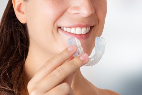 Women wearing Orthodontic silicon trainer