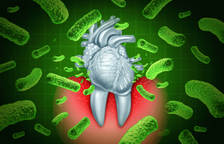 Stilisiertes Bild von einem Zahn und einem Herz, das von Bakterien attackiert wird