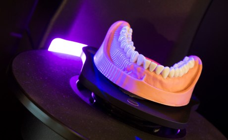 Ein Zahnmodell im digitalen Laserscanner
