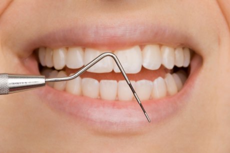 zahnärztliches Instrument vor halb geöffnetem Mund mit sichtbaren Zahnreihen
