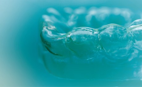 Nahaufnahme einer transparenten Zahnkorrekturschiene auf einem Zahnmodell vor blauem Hintergrund