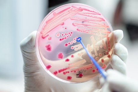 behandschuhte Hand hält Petrischale mit rosa Flecken darin