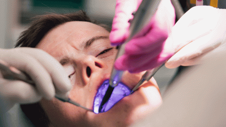 Nahaufnahme des Gesichts eines Patienten bei der Zahnbehandlung