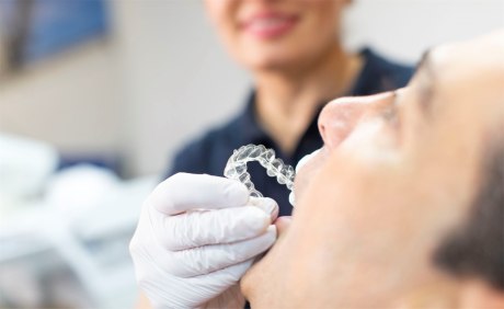 Durchsichtiger Alignerbogen wird vom Behandler in geöffneten Mund des Patienten geführt