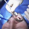 Bild einer zahnmedizinischen Behandlung