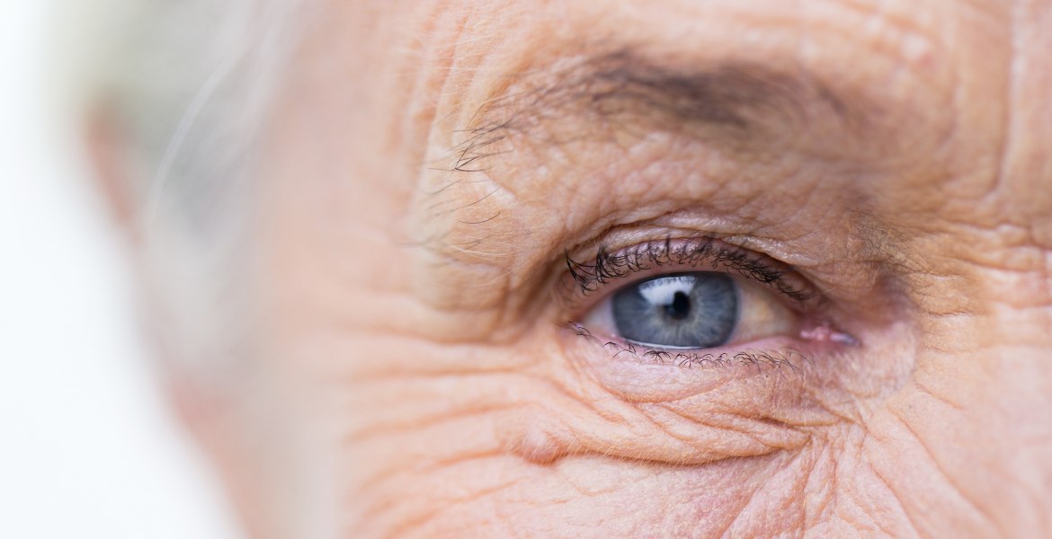 Ein Bild, das ein Auge mit blauer Iris einer älteren Frau zeigt