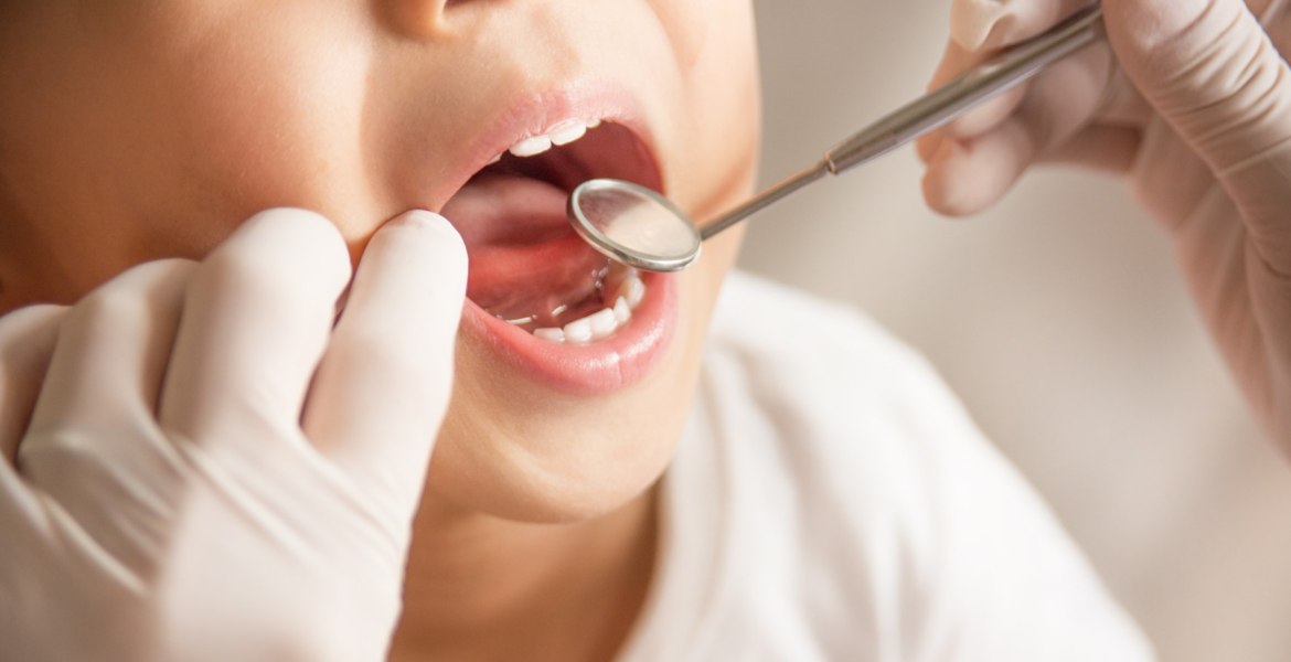 Offener Kindermund Spiegel Zahnarzt